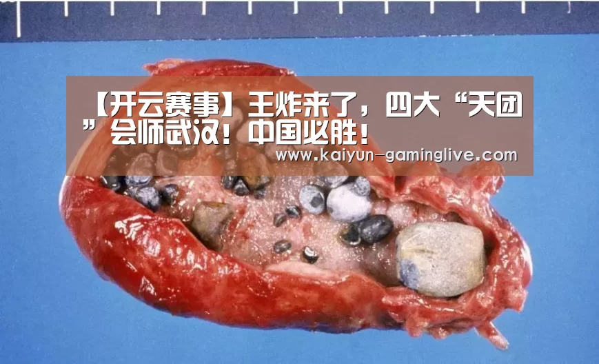 开云赛事